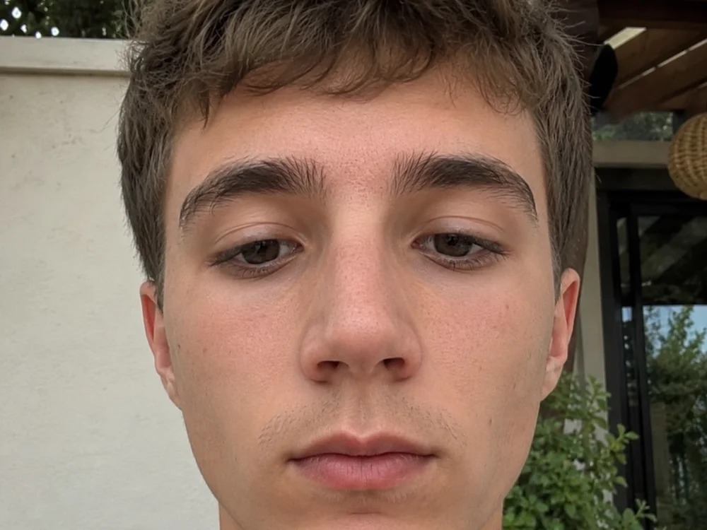Axel_20