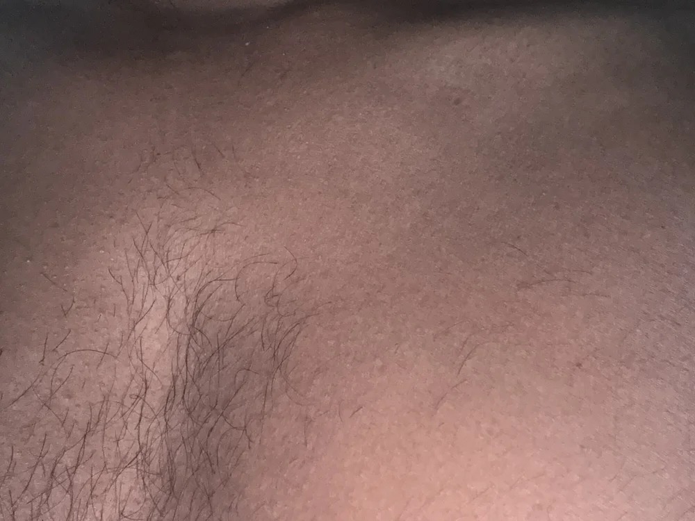 Blackbiger