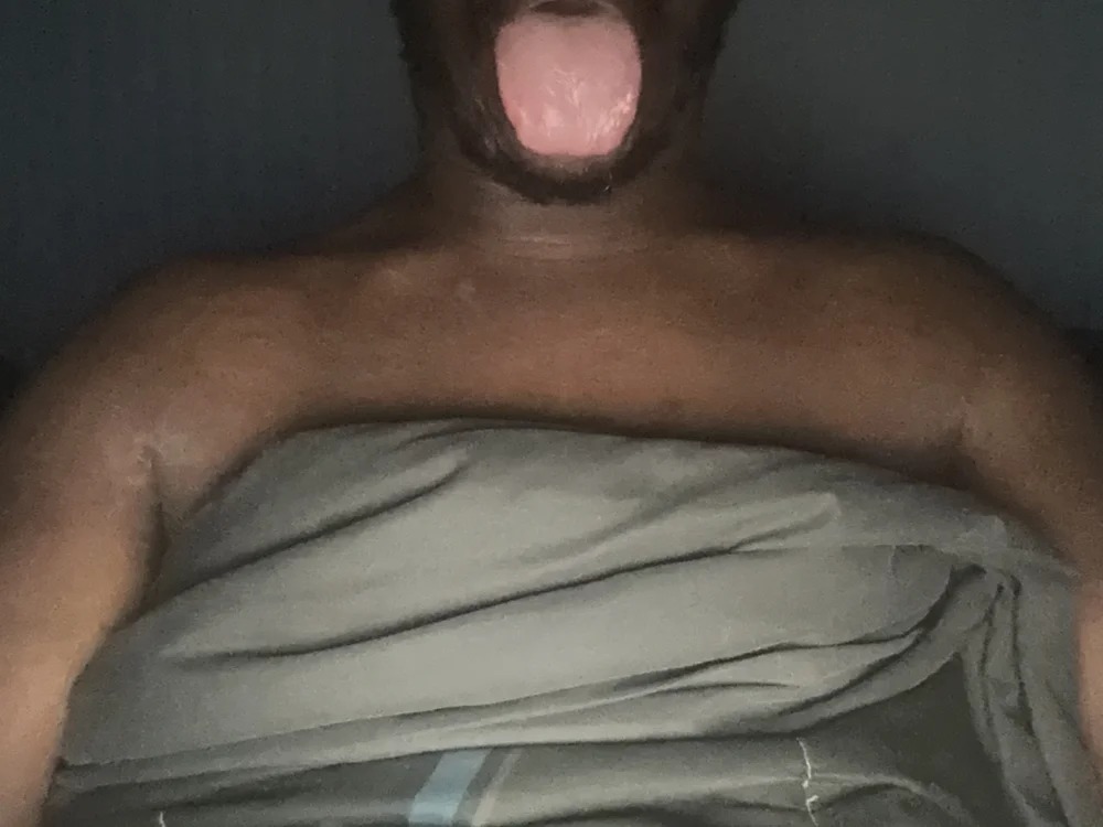 JTOXIC36