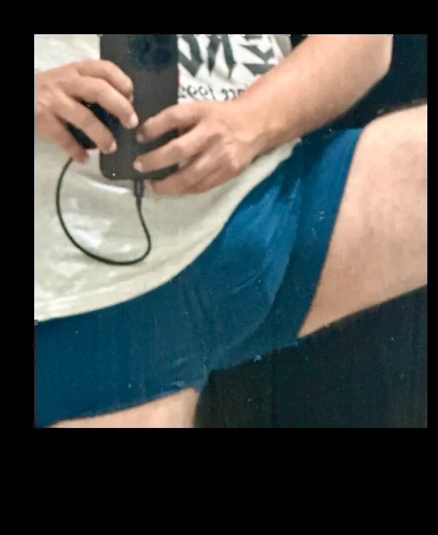POXmx