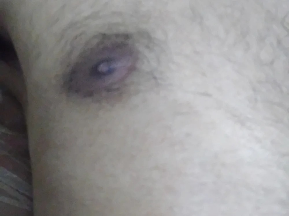 Upesk