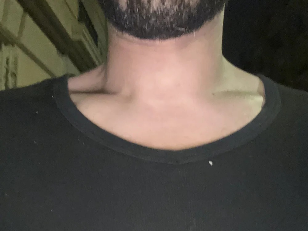 Versuce_99