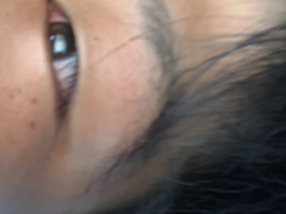 mdpon